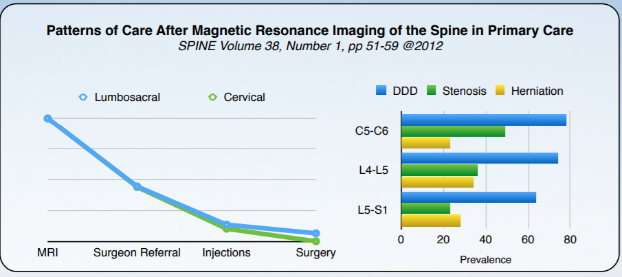 When Does an MRI Indicate That You Need Surgery?
